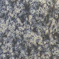 ASPC-1/GEM人转移胰腺腺癌细胞吉西他滨耐药株