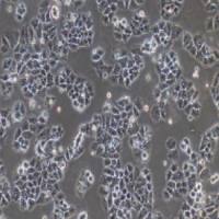 Caov-3人卵巢腺癌细胞(提供STR鉴定报告)