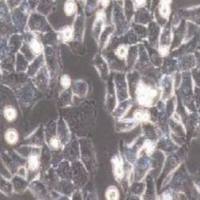 BT-B人宫颈癌细胞(提供STR鉴定报告)