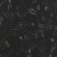 BEAS-2B人支气管上皮细胞(提供STR鉴定报告)