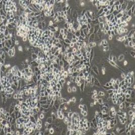A2780+GFP人卵巢癌细胞+GFP(提供STR鉴定报告)