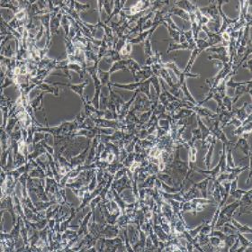 A172人胶质母细胞瘤细胞（提供STR鉴定报告）