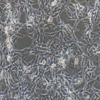 A172人胶质母细胞瘤细胞（提供STR鉴定报告）