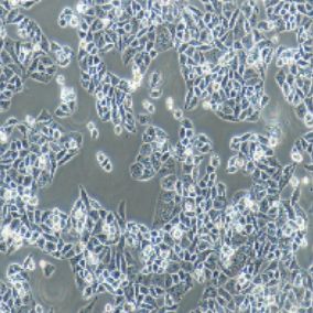 AN3CA人子宫内膜腺癌细胞