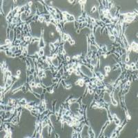 95-D人高转移肺癌细胞（提供STR鉴定报告）