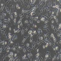 BT-549人乳腺管癌细胞(提供STR鉴定报告)