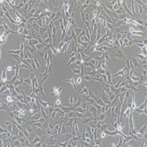 Calu-1人肺癌细胞(提供STR鉴定报告)