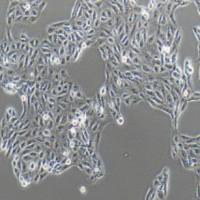 ACHN人肾癌细胞(提供STR鉴定报告)