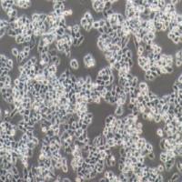 A2780人卵巢癌细胞(提供STR鉴定报告)