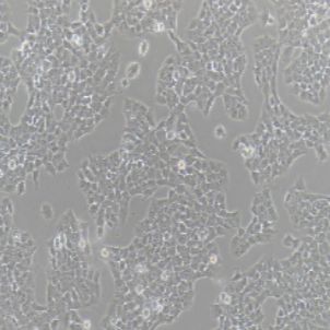 A673人横纹肌瘤细胞(提供STR鉴定报告)