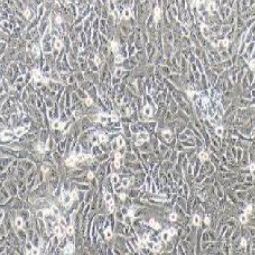 143B人骨肉瘤细胞（提供STR鉴定报告）
