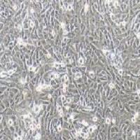 143B人骨肉瘤细胞(提供STR鉴定报告)