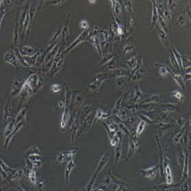 Caki-1人肾透明细胞癌皮肤转移细胞(提供STR鉴定报告)