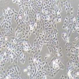CAL-27人舌鳞癌细胞(提供STR鉴定报告)