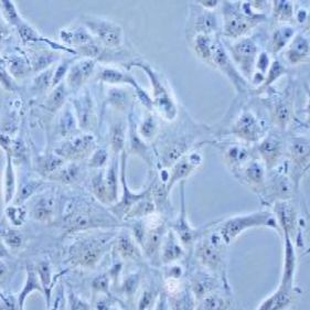 769-P人肾细胞腺癌细胞（提供STR鉴定报告）