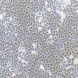 AV3人宫颈癌细胞(提供STR鉴定报告)