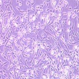 A-204人横纹肌肉瘤细胞(提供STR鉴定报告)
