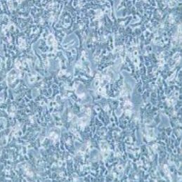 BIU-87人膀胱癌细胞(提供STR鉴定报告)
