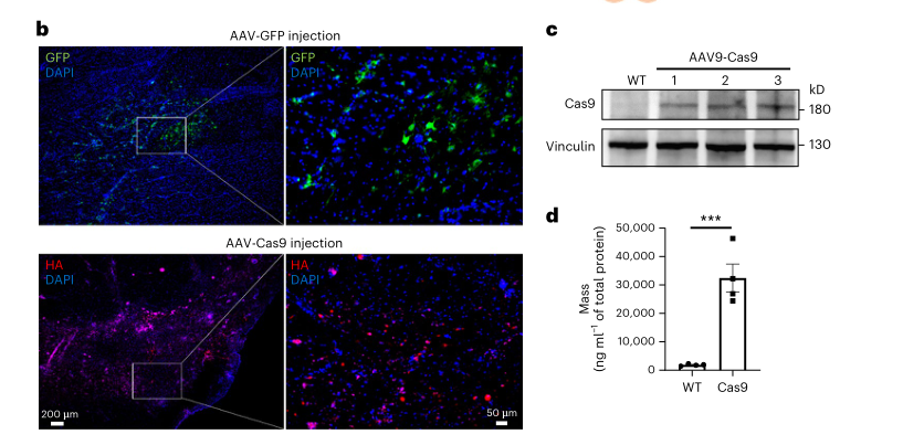 Nature子刊| 暨南大学李晓江教授团队在基因治疗神经退行性疾病大型动物模型方面取得新突破