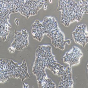 BT-474人乳腺导管癌细胞(提供STR鉴定报告)