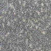 HELA+luc人宫颈癌细胞荧光素酶标记