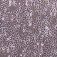 HCC-LM3高转移人肝癌细胞