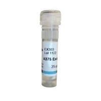 Instant exosomes from A375 冻干外泌体 EX303