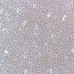 HBL-100人整合SV40基因的乳腺上皮细胞(提供STR鉴定报告)