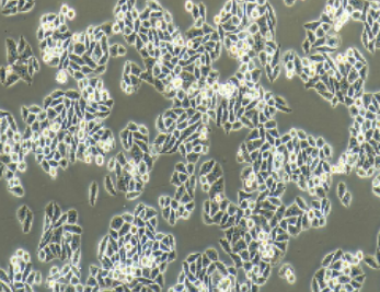 Eca-109人食管癌细胞(提供STR鉴定报告)