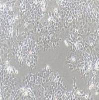 FADU人咽鳞癌细胞(提供STR鉴定报告)