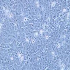 HCC-94人子宫鳞癌细胞(高分化)