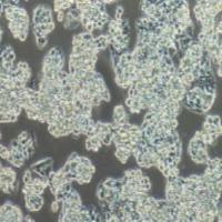 Hep G2.2.15人肝癌(HBV)细胞