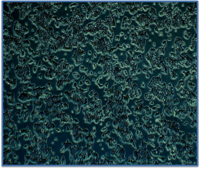 MCF-7(人乳腺癌细胞)培养建议