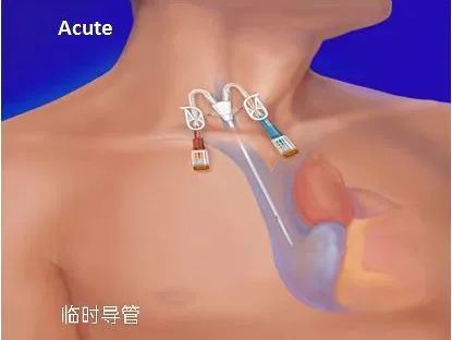 血液透析导管的维护,患者应该这样做!