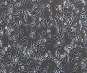 Hep3B2.1-7人肝癌细胞(提供STR鉴定报告)