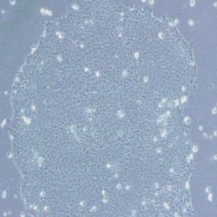 H9人胚胎干细胞（提供STR鉴定报告）