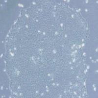 H9人胚胎干细胞(提供STR鉴定报告)