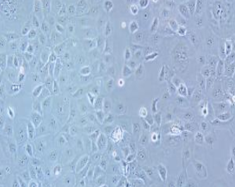 HCC1937人乳腺癌细胞(提供STR鉴定报告)