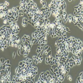 Eca-109人食管癌细胞(提供STR鉴定报告)
