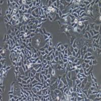 HO-8910PM人高转移卵巢癌细胞