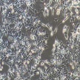 LOVO/5FU人结直肠癌细胞氟尿嘧啶耐药株