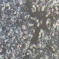 LOVO/5FU人结直肠癌细胞氟尿嘧啶耐药株