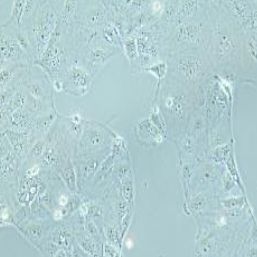 HuH-6人肝母细胞瘤细胞(提供STR鉴定报告)