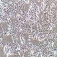 MCF-7+luc 人乳腺癌细胞+luc