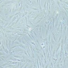 KGN人卵巢颗粒细胞瘤细胞(提供STR鉴定报告)