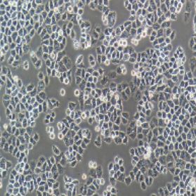 IOSE-80人正常卵巢上皮细胞(提供STR鉴定报告)