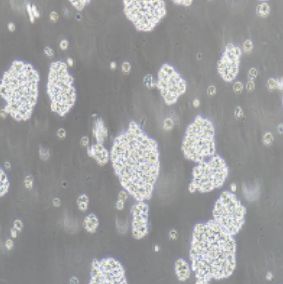 Jurkat（clone E6-1）人T淋巴细胞白血病细胞(提供STR鉴定报告)