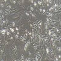 MDA-MB-231+luc 人乳腺癌细胞+luc