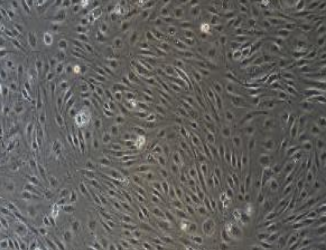 HUVEC+RFP人脐静脉内皮细胞永生化+RFP