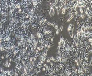 LOVO/5FU人结直肠癌细胞氟尿嘧啶耐药株